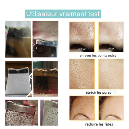 Épurateur de peau à ultrason