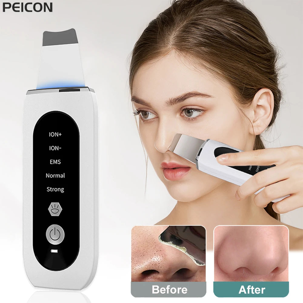 Épurateur de peau à ultrason