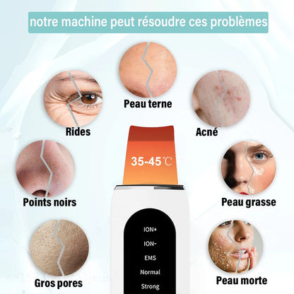 Épurateur de peau à ultrason
