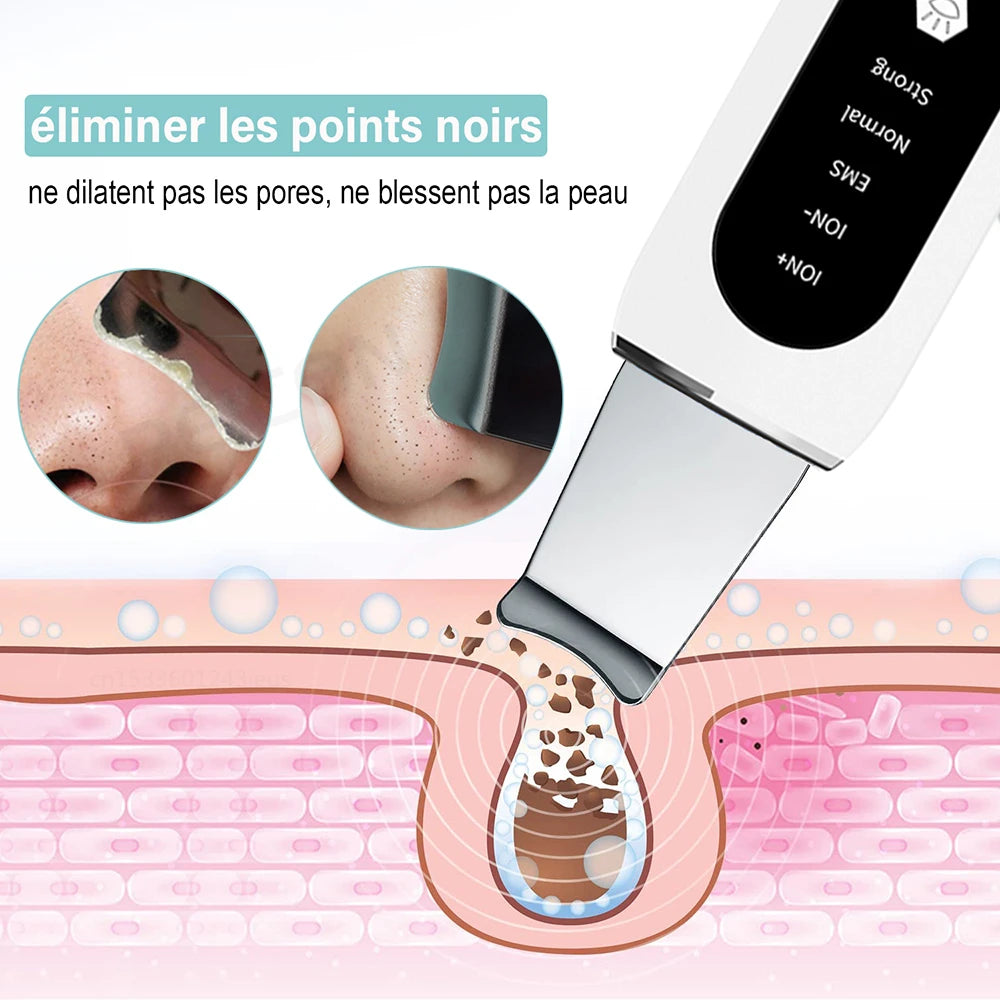 Épurateur de peau à ultrason